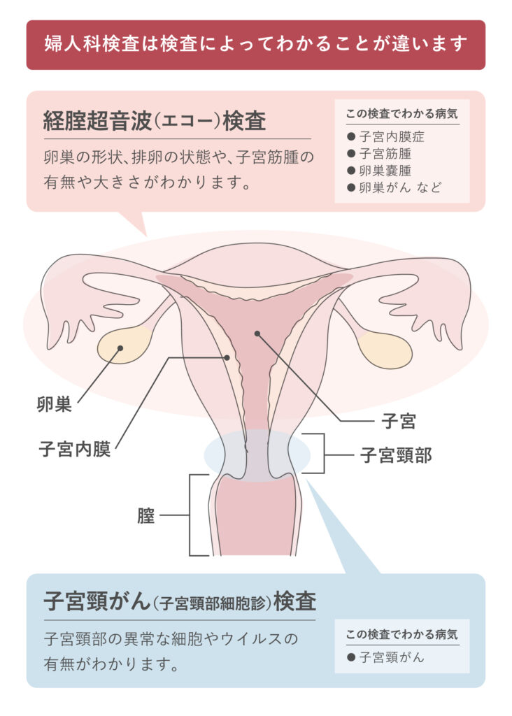 婦人科検診の検査項目と、検査でわかる病気を詳しく解説