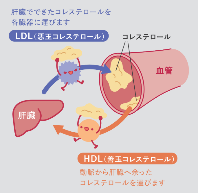 脂質異常症とは?原因や改善方法・|女性の更年期に急増する理由【医師監修】